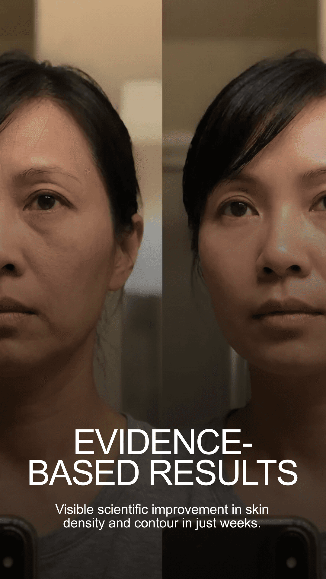 Evidence-Based Results β Visible scientific improvement in skin density and contour in just weeks